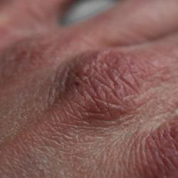 La Minute Diététique : peau sèche
